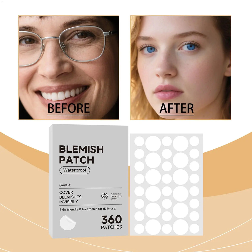 Anti-ance Patch Acne Marks Concealer Dots Repair Face Zit Hydrocolloid Waterproof Acne Spot Covering Patches Concealer Sticker Qme