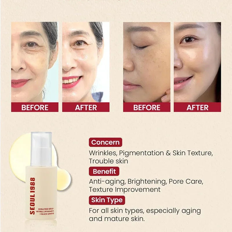 Seoul 1988 Retinol Ginseng Eye & Face Cream Serum Set Firming Moisturizing Diminish Lines Wrinkles Skin Care Essences Qme