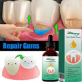Gum Repair Drops Relieve Receding Gingival Swelling Gum Cleaning Care Oral Periodontal Hygiene Remove Yellow Remove Stain Qme 1pc