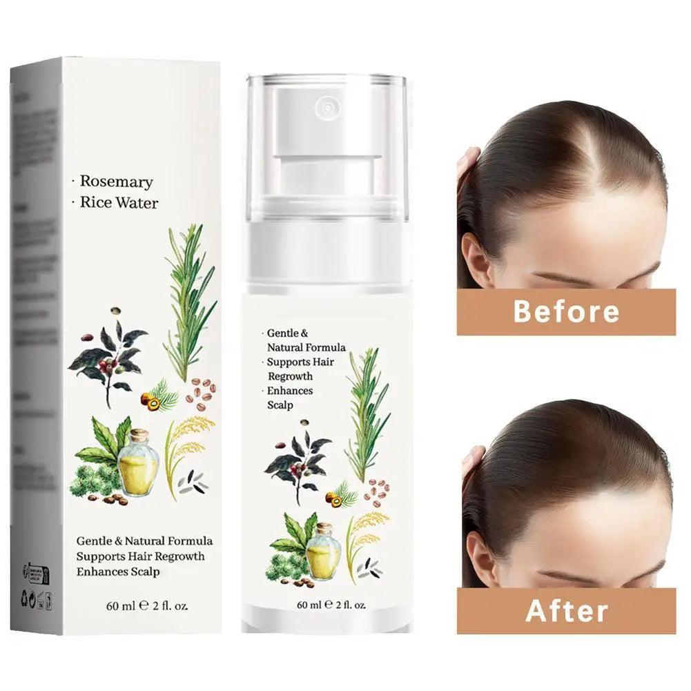 Hair Strengthening Serum - Scalp Nourishing Adds Volume, Hydrates Dry Hair, And Enhances Shine Dry Hair Qme 1pcs CN