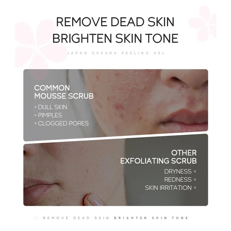LAIKOU Sakura Peeling Gel Facial Exfoliation Cleans Pores Qme