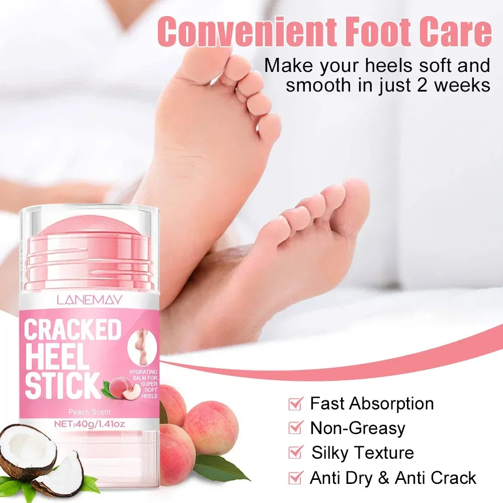 Ultra-Hydrating Foot Care Cream Anti-Drying Crack Removal Dead Moisturizing Skin Hand Feet Care Softening Calluses Cracked Cream Qme