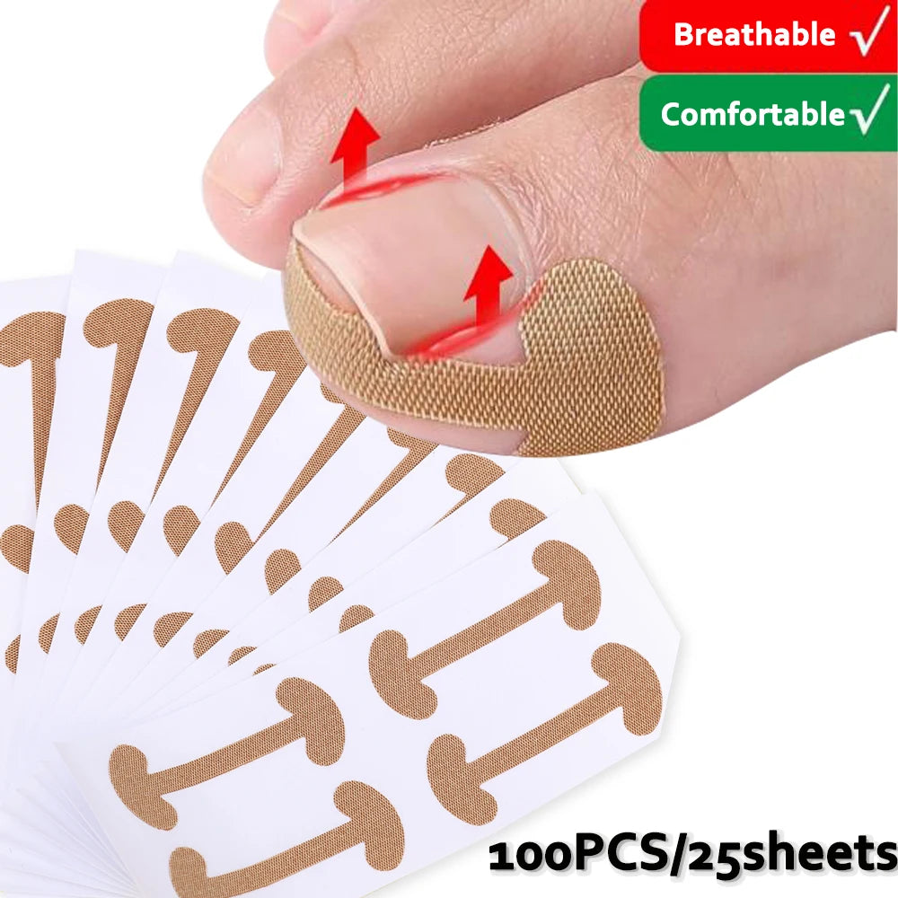 100PCS Ingrown Toenail Correction Strips Lasting Adhesion Waterproof Nail Correction Stickers Elasticity Toe Care Pedicure Tools Qme