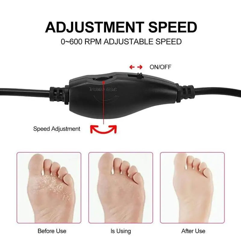 Electric Foot File for Home Use - Removes Dead Skin, Calluses & Hard Skin, Complete Pedicure Set for Smooth Feet" Qme