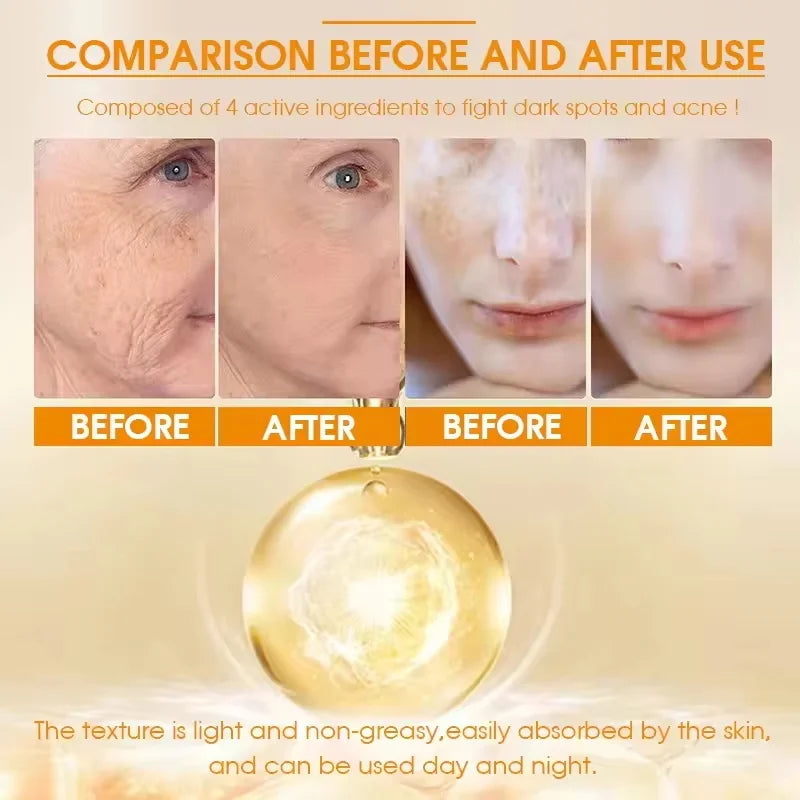 Turmeric Freckle Removing Whitening Essence Fade Pigmentation Melasma Dark Spots Corrector Repair Serum Korean Skin Care Qme