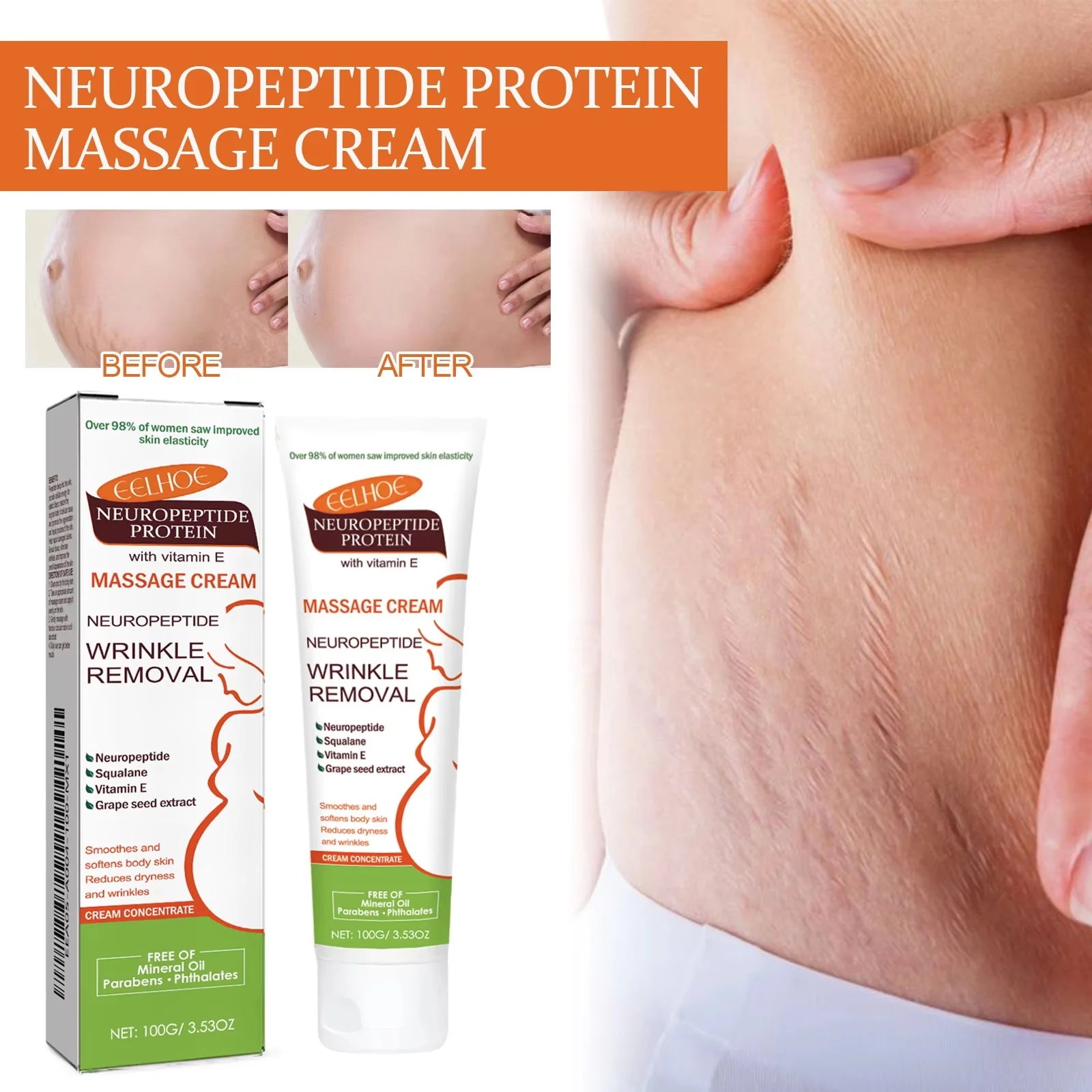 100g Stretch Marks Permanent Removal Cream Maternity Pregnant Women Pregnancy Anti-Winkle Smooth Repair Firming Skin Body Care Qme