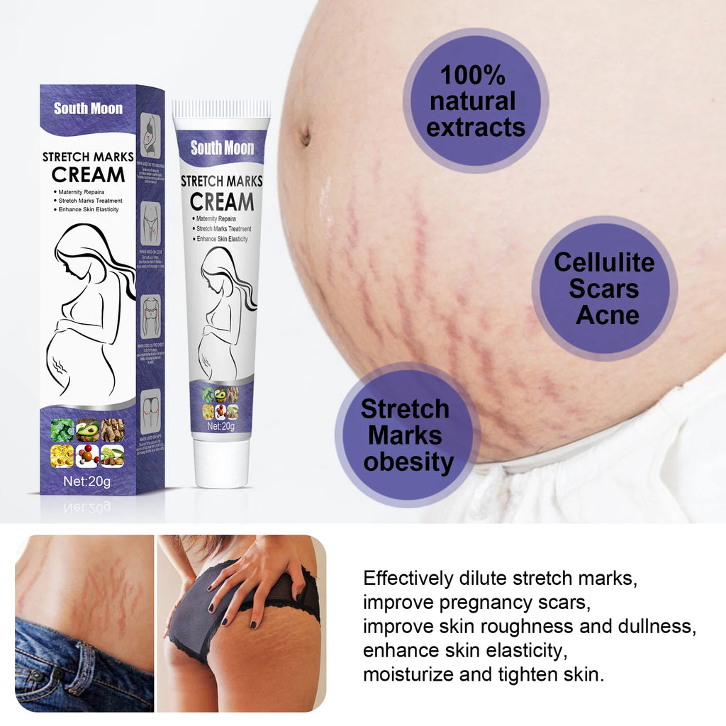 Remove Pregnancy Stretch Marks Cream Improves Elasticity Fade Growth Lines Smoothing Nourishing Moisturizing Firming Skin Care Qme