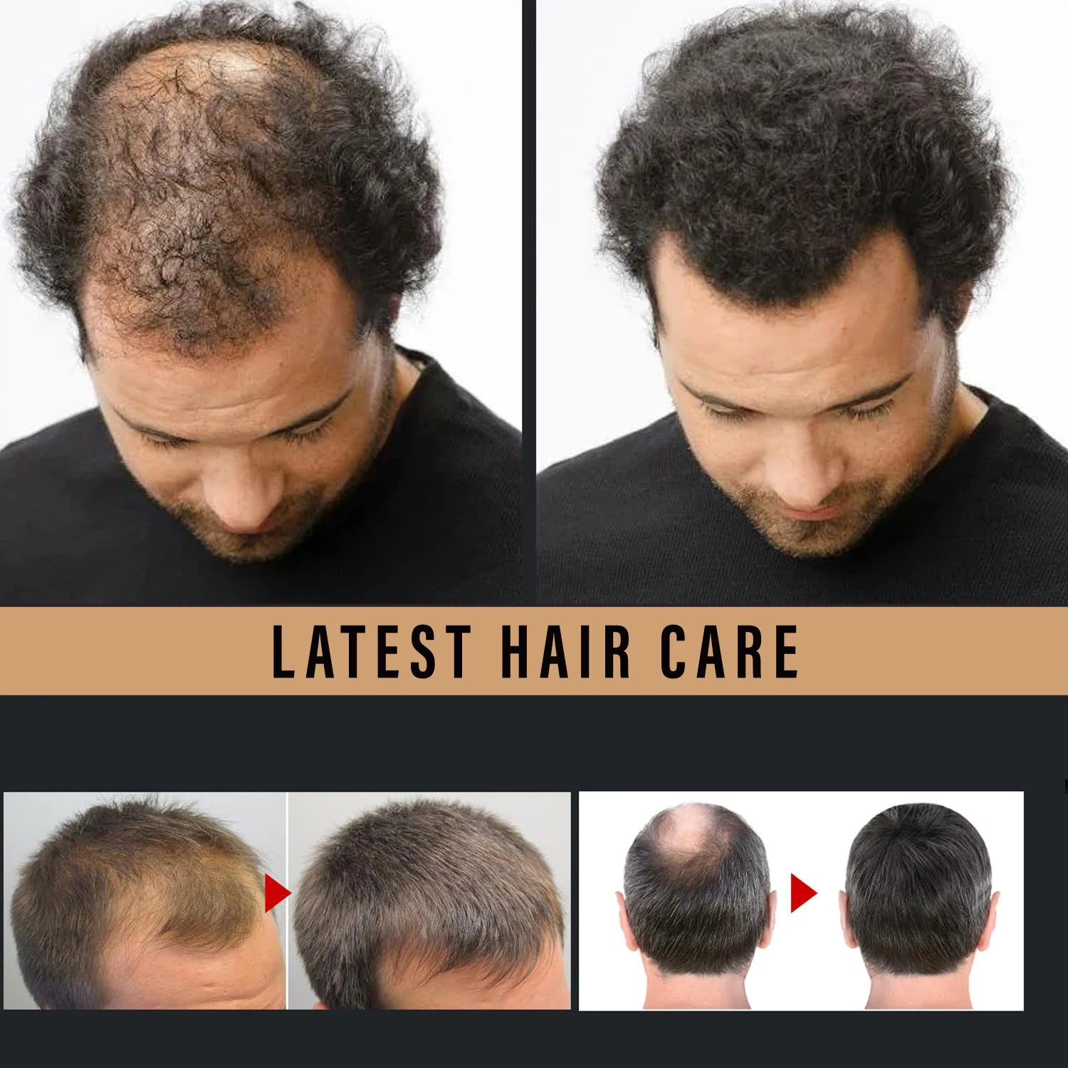 Repairing Hair Spray Suitable for All Hair Types, Smoothing, Moisturizing, and Enhancing Elasticity, Ideal for Dry Hair. Qme