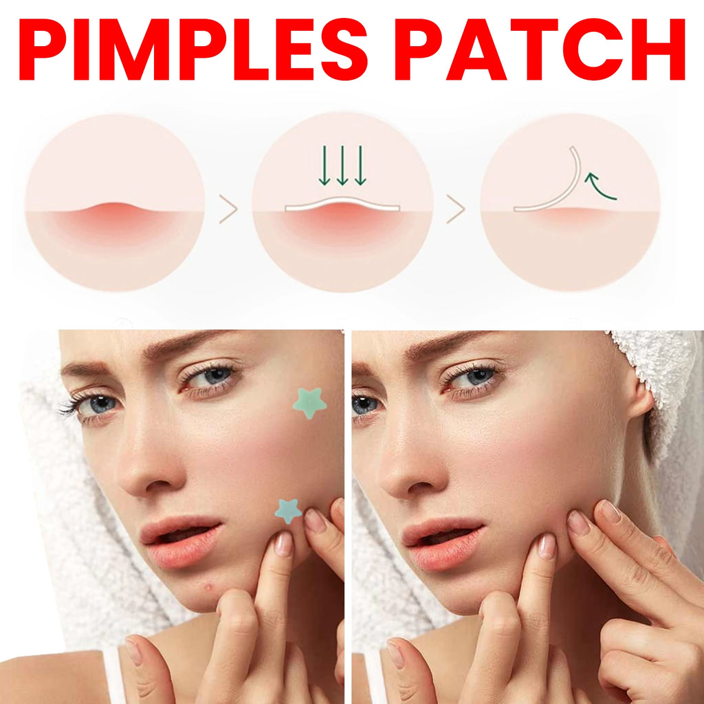 200Pcs Repair Acne Patch Fade Blemishes Pimple Marks Closed Acne Blemishes Hydrocolloid Star Shaped Cover Acne Pimple Patch Qme