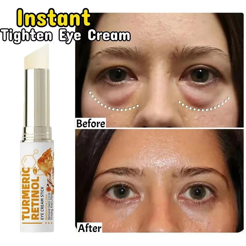 Instant Eye Bag Remove Eye Cream Anti Fat Particles Dark Circles Puffiness Fade Fine Lines Lift Brighten Korean Beauty Eye Care Qme
