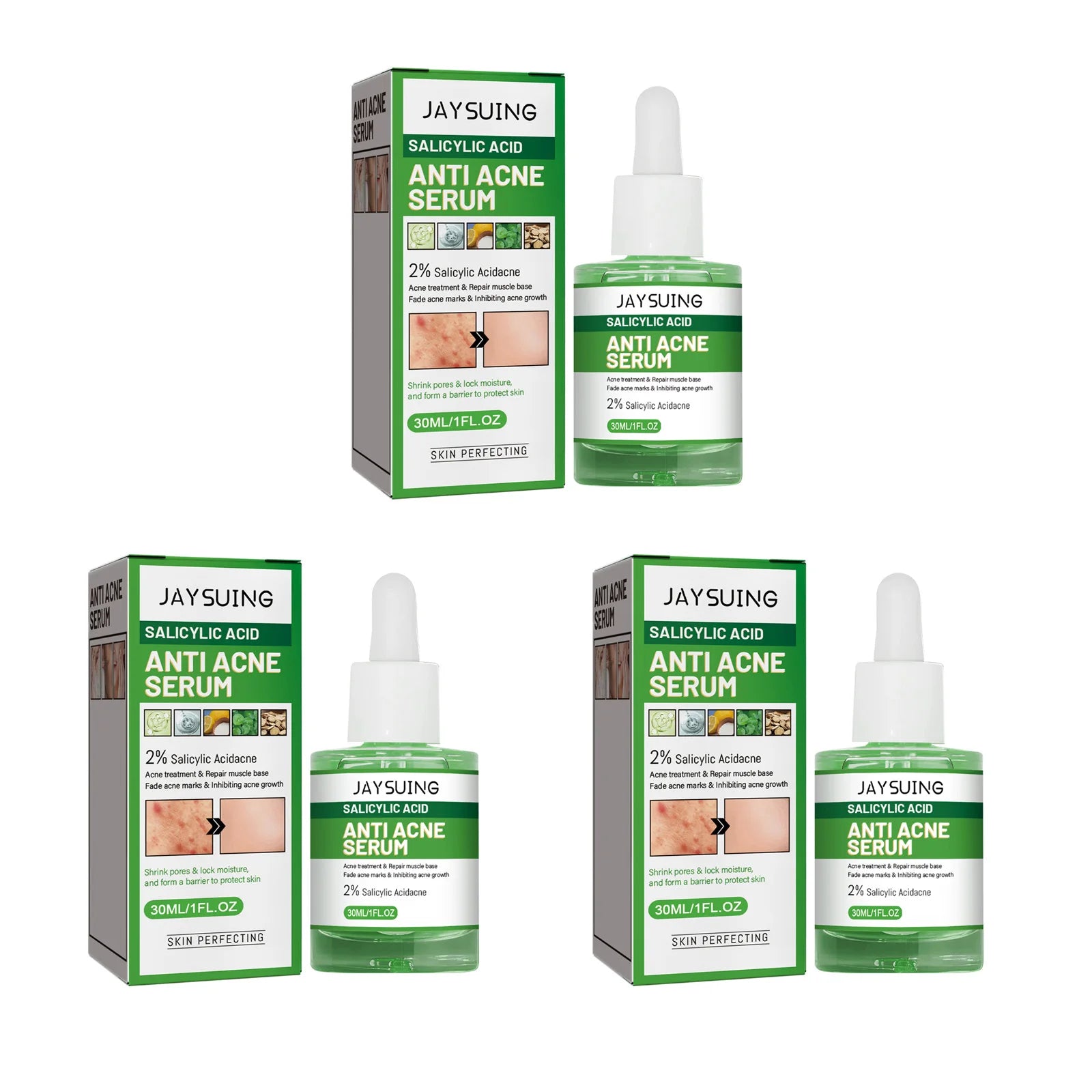 Salicylic Acid Anti Acn-e Face Serum Hydrating Fader Acne Mark Pimple Blackhead Removal Shrink Pores Oil Control Facial Essence Qme 3 x 30ml Boxed