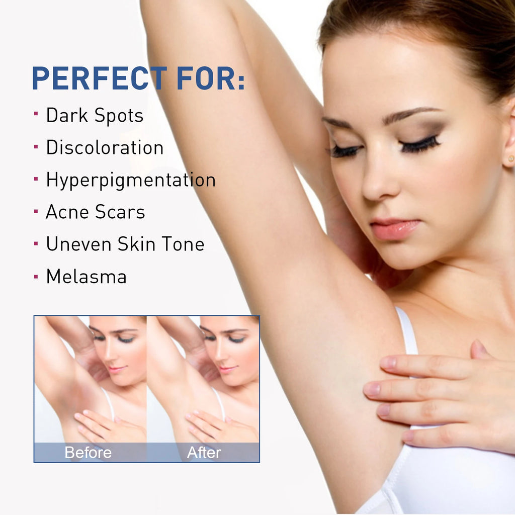 Whitening Cream To Private Area Armpits Bikini Zone Reduce Dark Spots Improve Luster Brighten Skin Moisturizing Body Care Lotion Qme