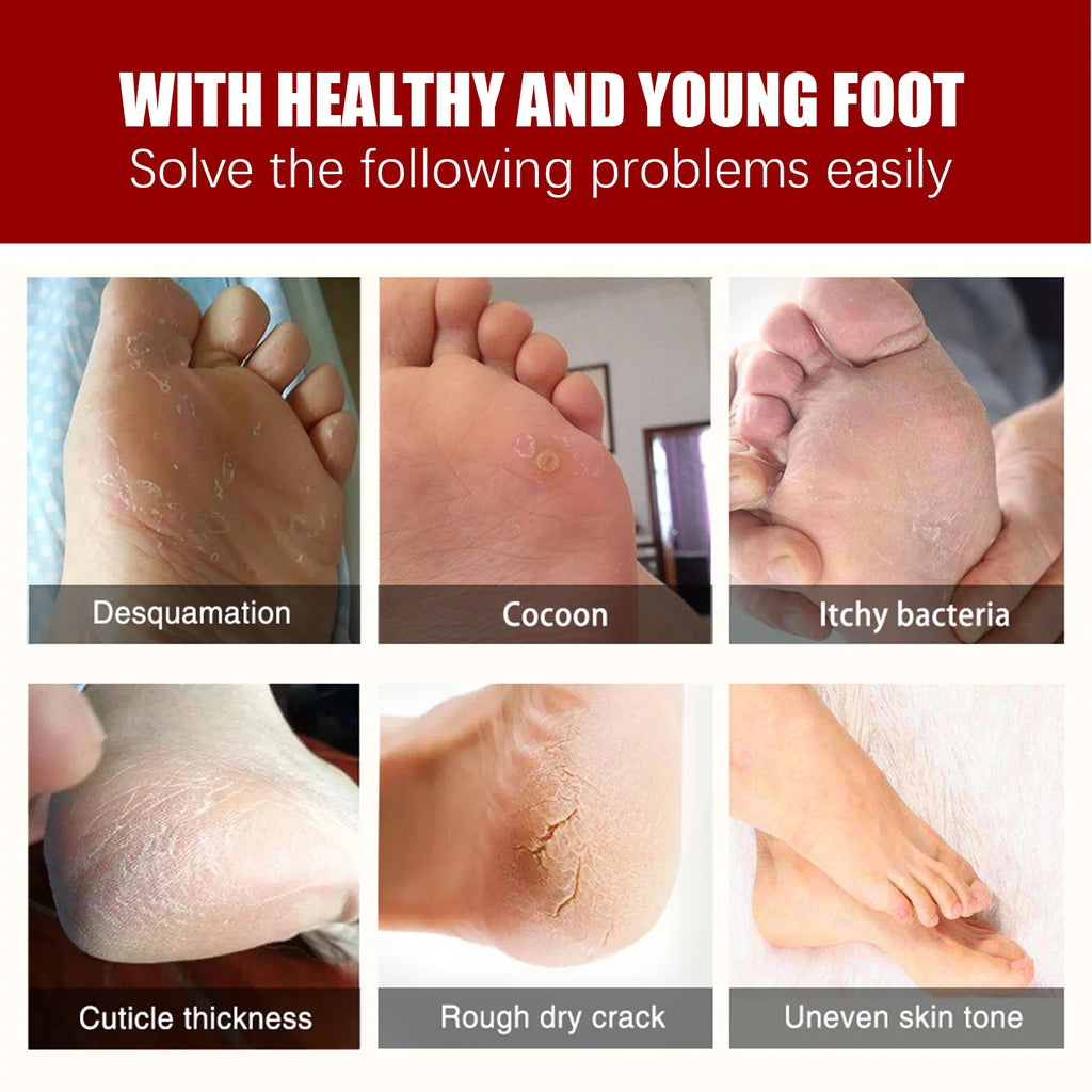 AHA Exfoliating Foot Mask Moisturizing Anti Crack Heel Foot Calluses Dead Skin Remover Smooth & Soft Feet Care Foot Patch Qme