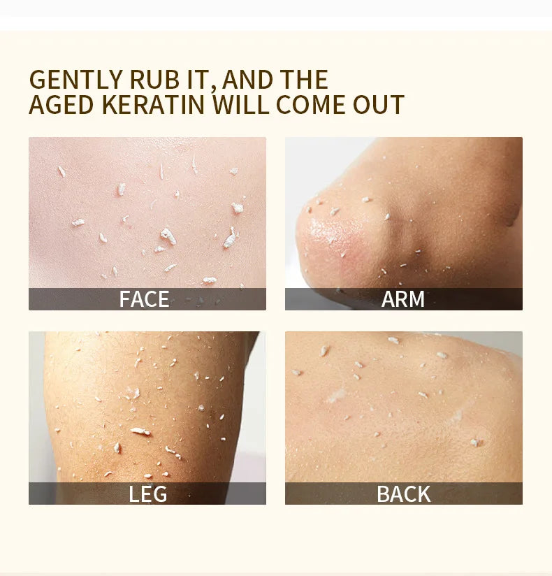 Face Exfoliating Gel Deep Cleansing Pores,Remove Dead Skin Purify Gentle Exfoliate Oil Control Moisturizing Face Scrub Skin Care Qme