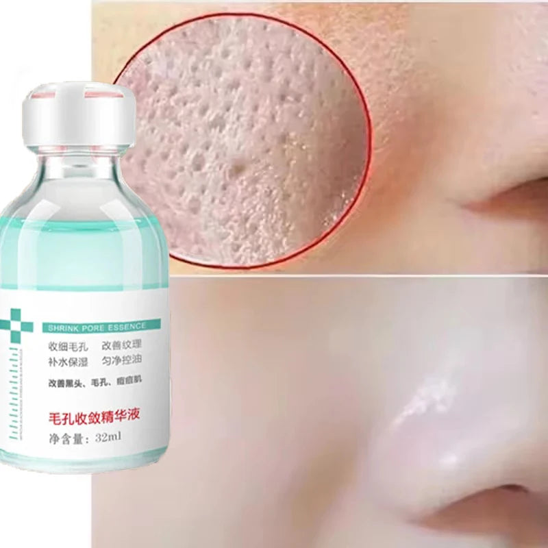 Remove Large Pores Serum Lactic Acid Facial Pore Shrinking Repairing Qme