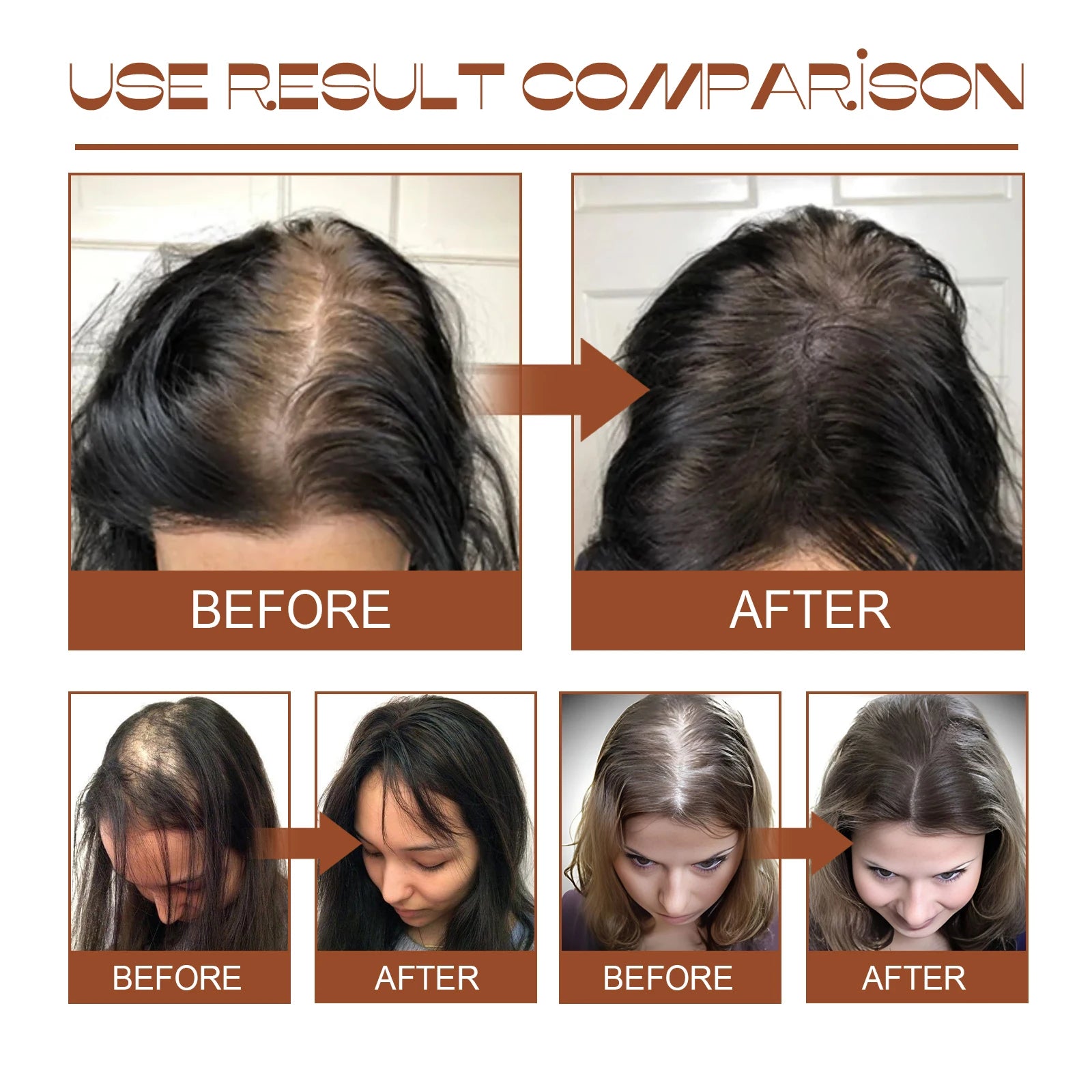 100% Pure Organic Hair Mask Batana Oil Hair Growth Oil Natural Treatment Nourish Reduce Hair Loss Anti-Breakage Qme