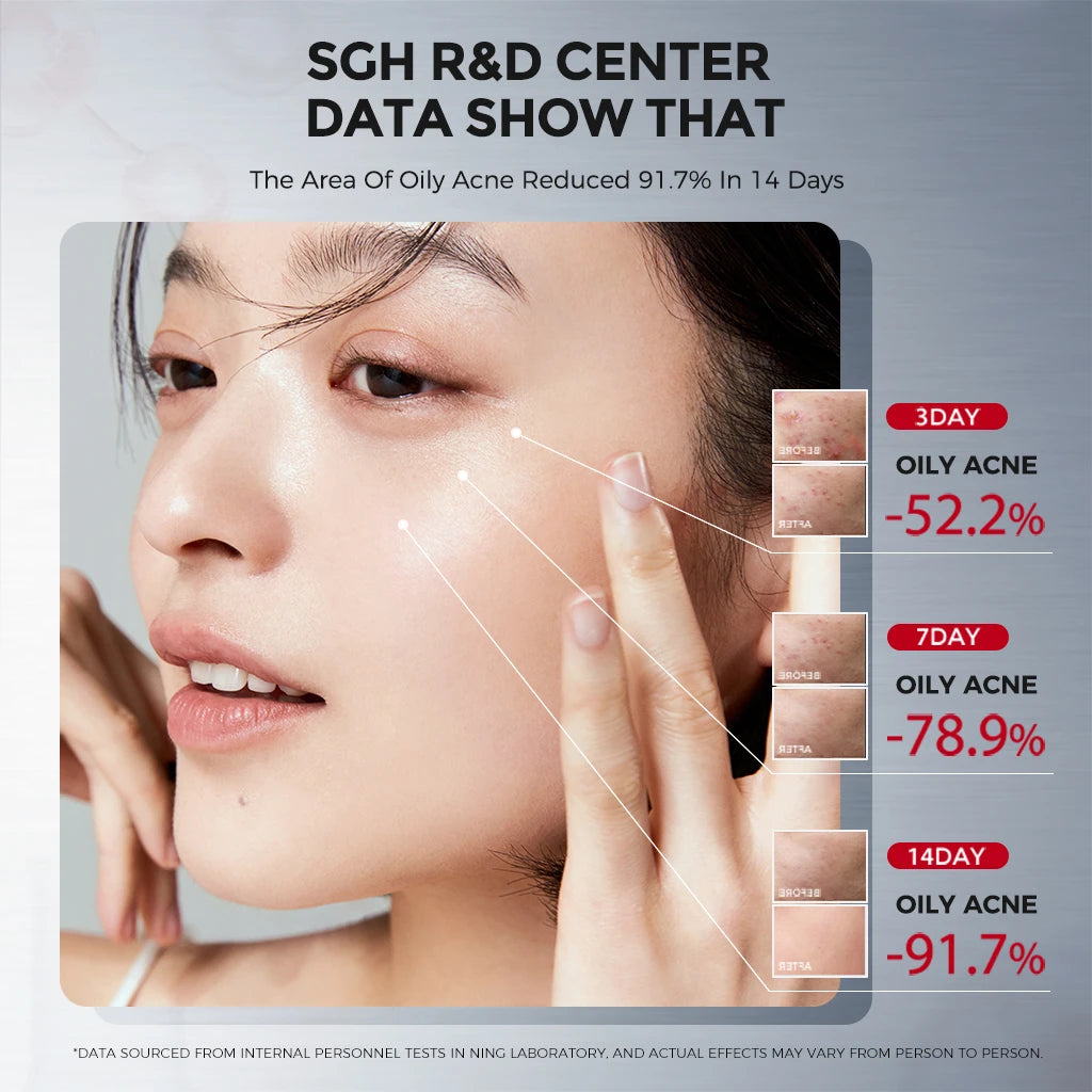 NING WHITEHEAD REMOVAL TONER MINIMIZES PORES REDUCES BLACKHEADS Qme