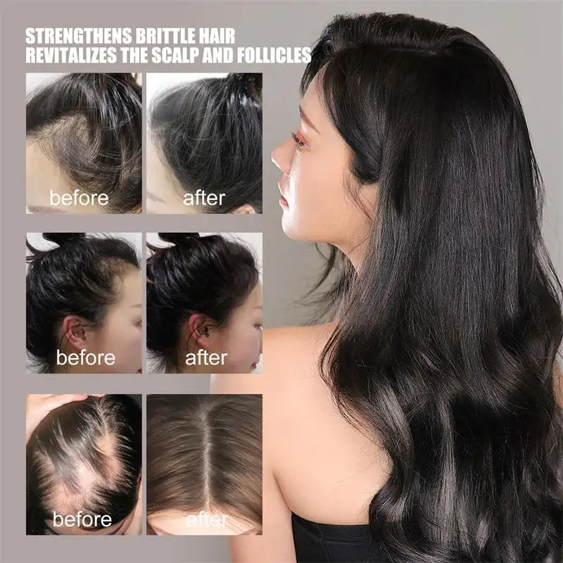 Hair Growth Serum Anti Loss Regrowth Hair Growth Oil Prevent Baldness Repair Damage Scalp Massage Moisturizing Nourish Hair Care Qme