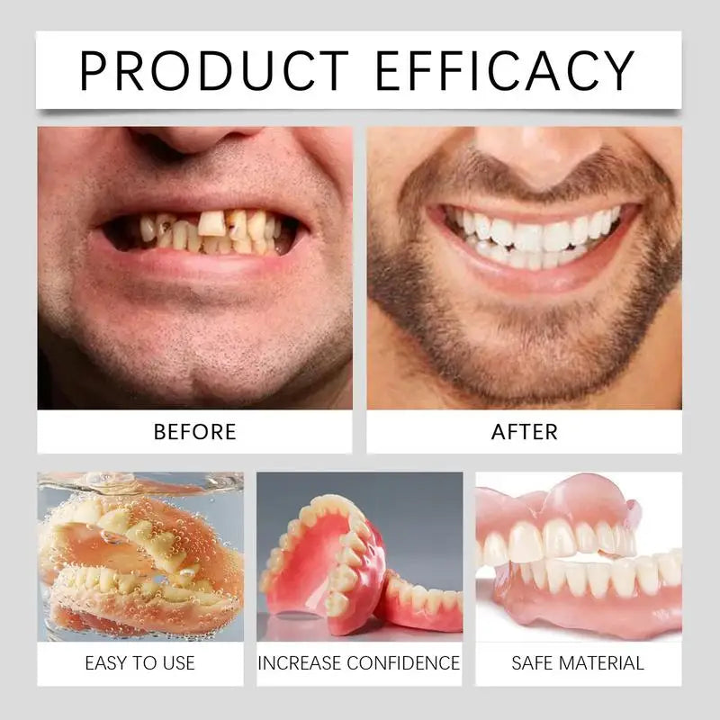 Denture Relines Silicone Liners Soft Fit Temporary Orthodontic Teeth Qme