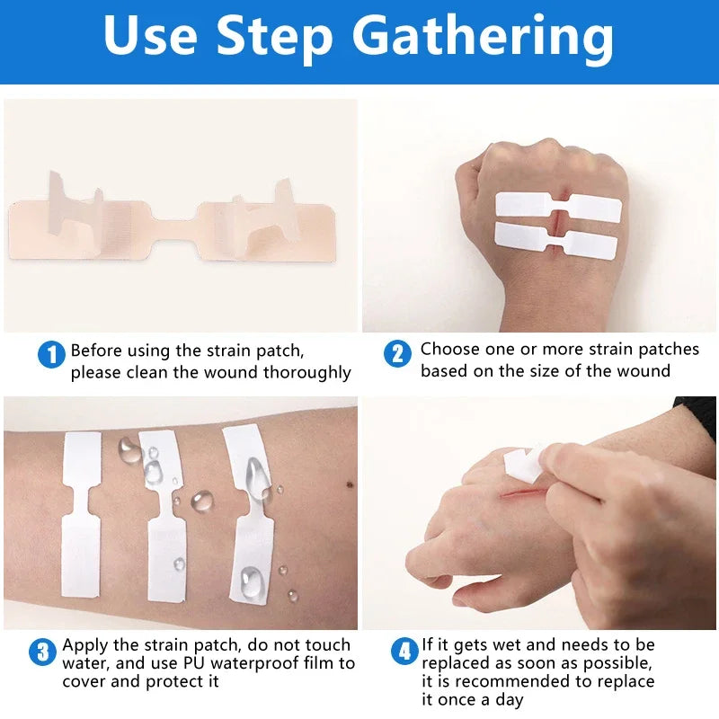 1 3 10 50 Patches Butterfly Closure Bandage Strips Adhesive Strip Qme