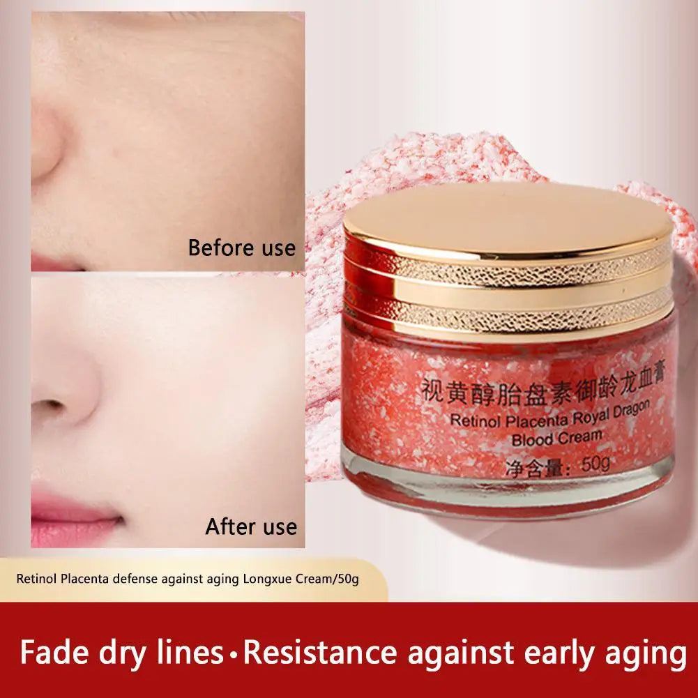 Dragons Blood Easy Cream, Retinol Placenta Dragon Blood Face Cream, Anti Wrinkle Cream For Women Rejuvenate Skin Care 50g Qme