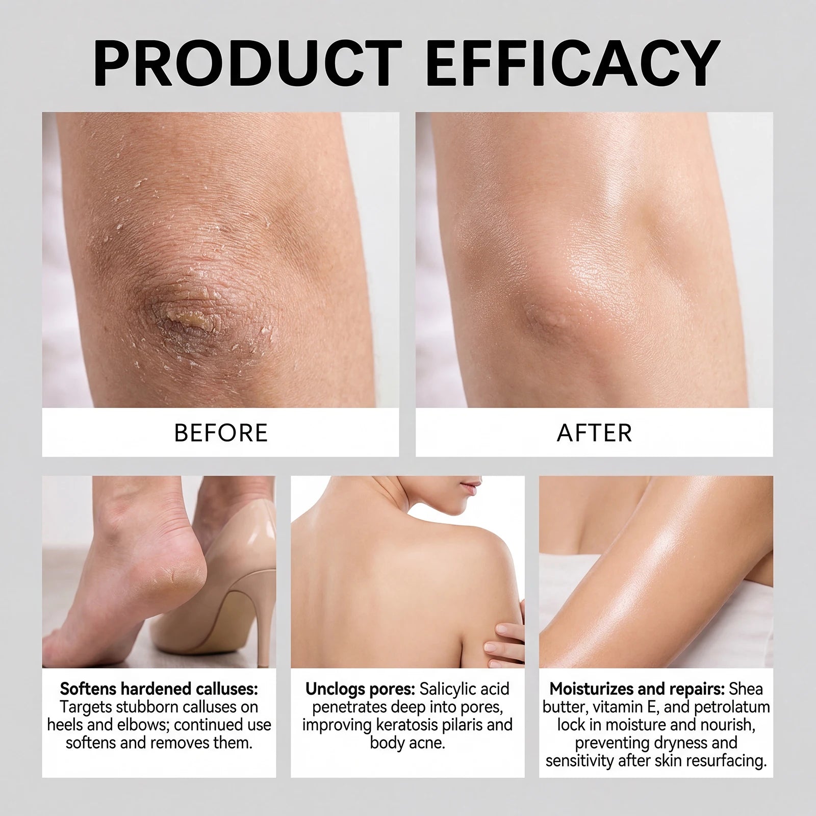 Exfoliating Body Stick Smoothing AHA BHA Shea Butter Moisturizing Skin Softening Body Exfoliator for Dry Skin Dead Skin Remover Qme