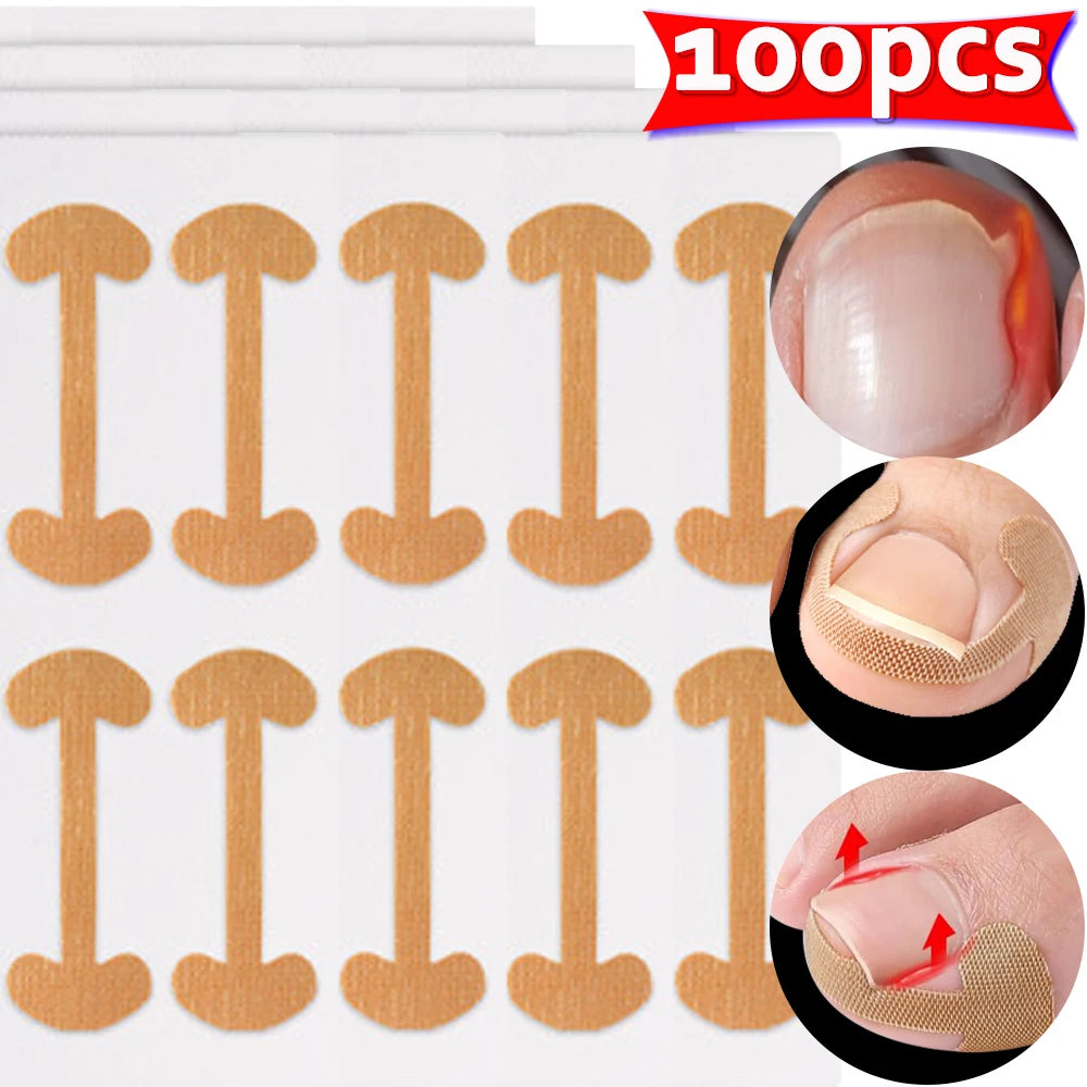 100PCS Ingrown Toenail Correction Strips Lasting Adhesion Waterproof Nail Correction Stickers Elasticity Toe Care Pedicure Tools Qme