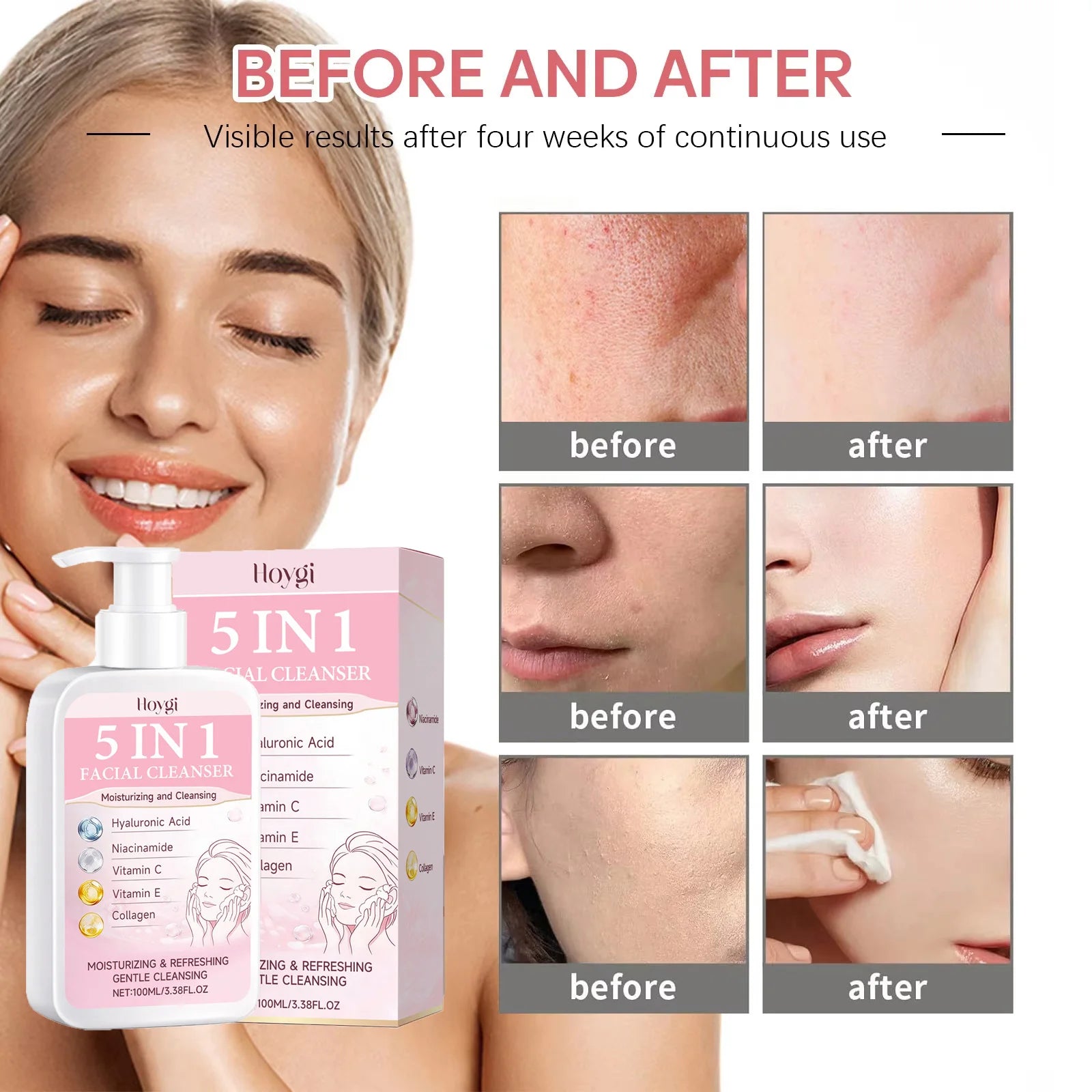 5 in 1 Moisturizing Facial Cleanser Refreshed Cleansing Makeup Remover Brightening Hydrating Light Texture Rich Foam Cleanser Qme