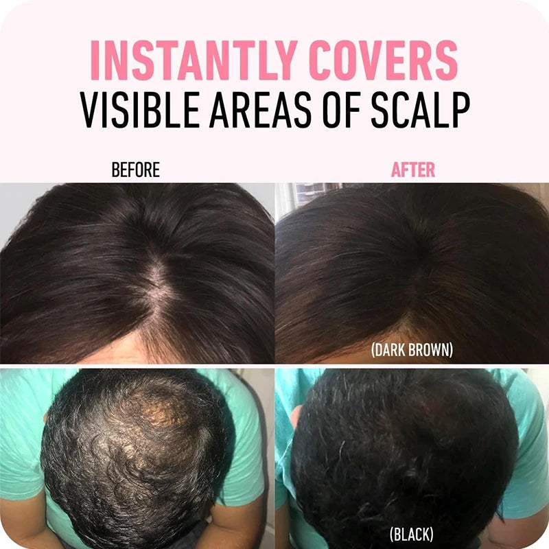 4 Color Hair Line Powder Black Root Up Natural Instant Waterproof Hairline Shadow Concealer Coverage Paint Repair Fill In Hair Qme
