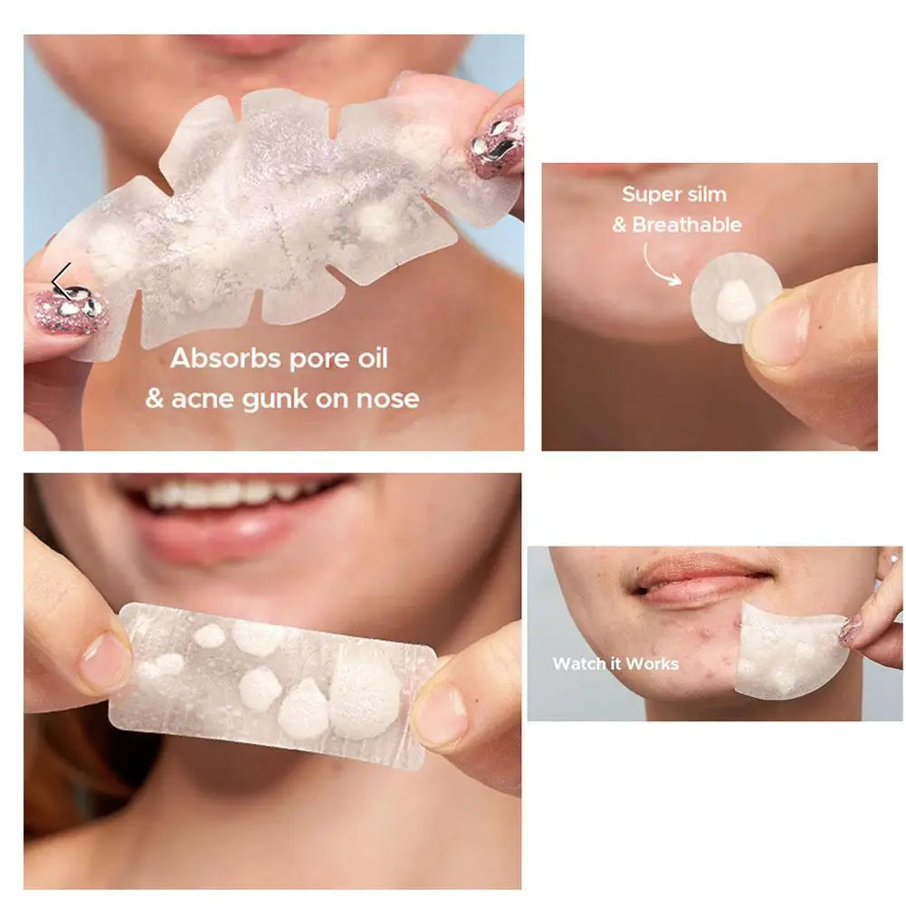 Large Pimple Patches Bulk Face 5 Sizes Hydrocolloid Acne Covering Qme