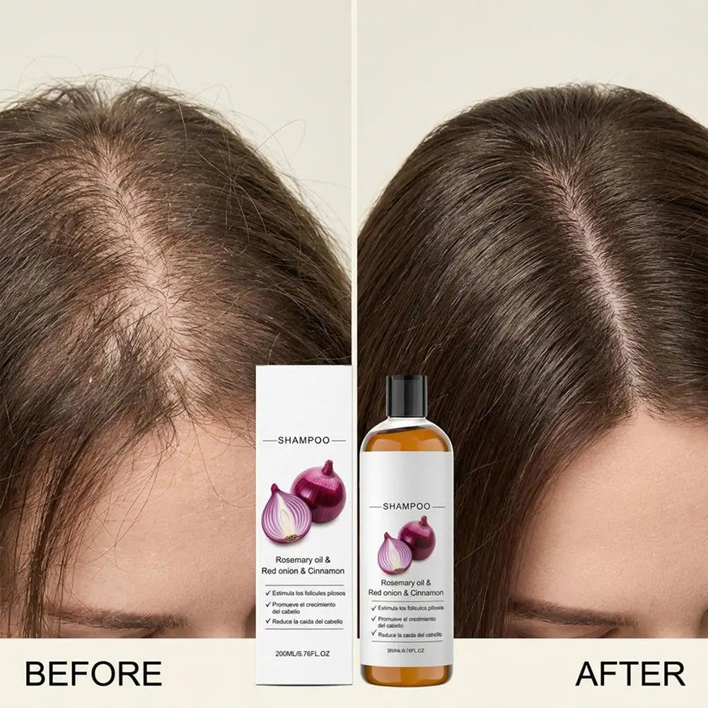 Rosemary Red Onion Shampoo/Conditioner Anti Hair Loss Promote Thicker Stronger excalvo Shampoo/Conditioner Hair Care Qme
