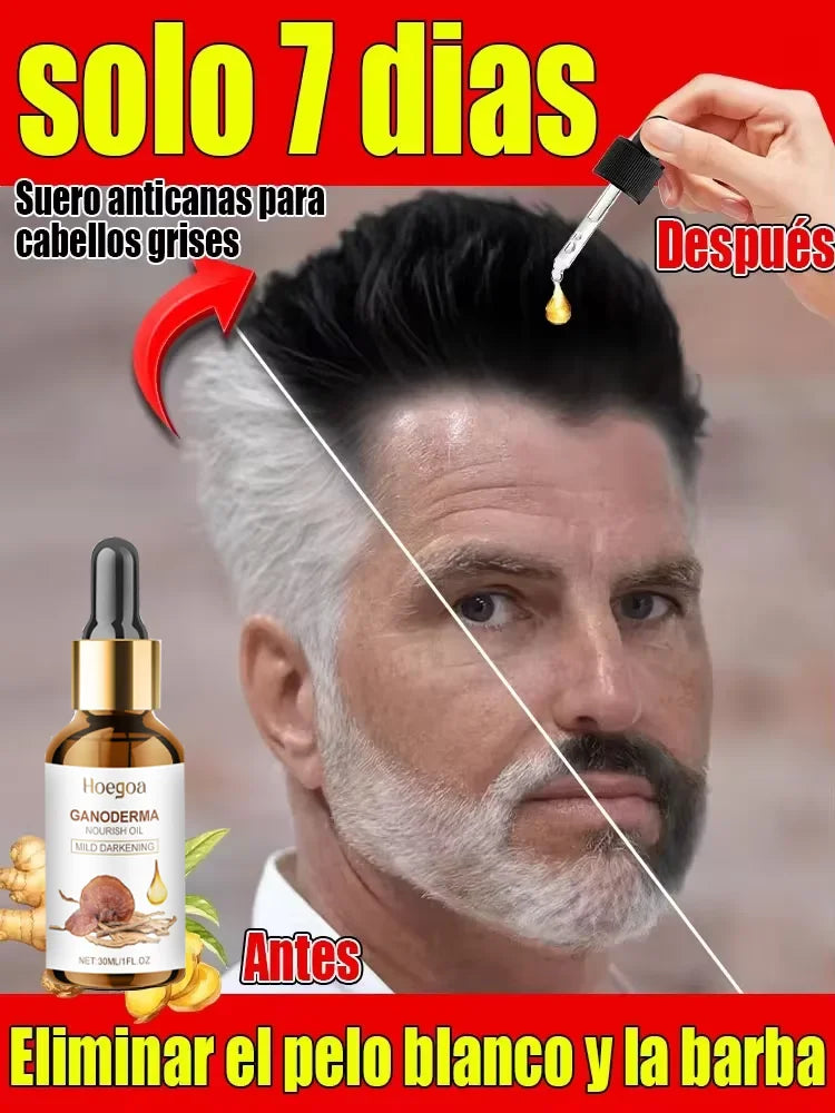 Natural antigen serum: Recover dark hair within 7 days and prevent 98% gray hair appearance - Plant extract Qme