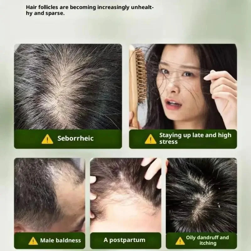 Usman Grass & Platycladus Shampoo Soap Strengthen Hair Root Growth Shampoo Bar Natural Herbal Hair Loss Treatment Hair Care Qme