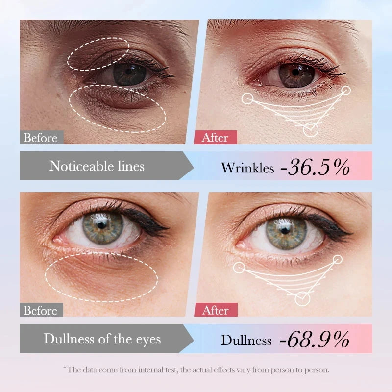 SADOER 4in1 Roll-on Moisturizing Eye Cream Anti Dark Circles Eyes Bags Firming Moisturizing Eye Serum Skin Care for Beauty Eyes Qme