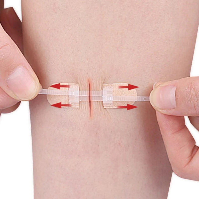 Strap Zipper Wound Closure Patches Care Braces Supports Breathable Qme