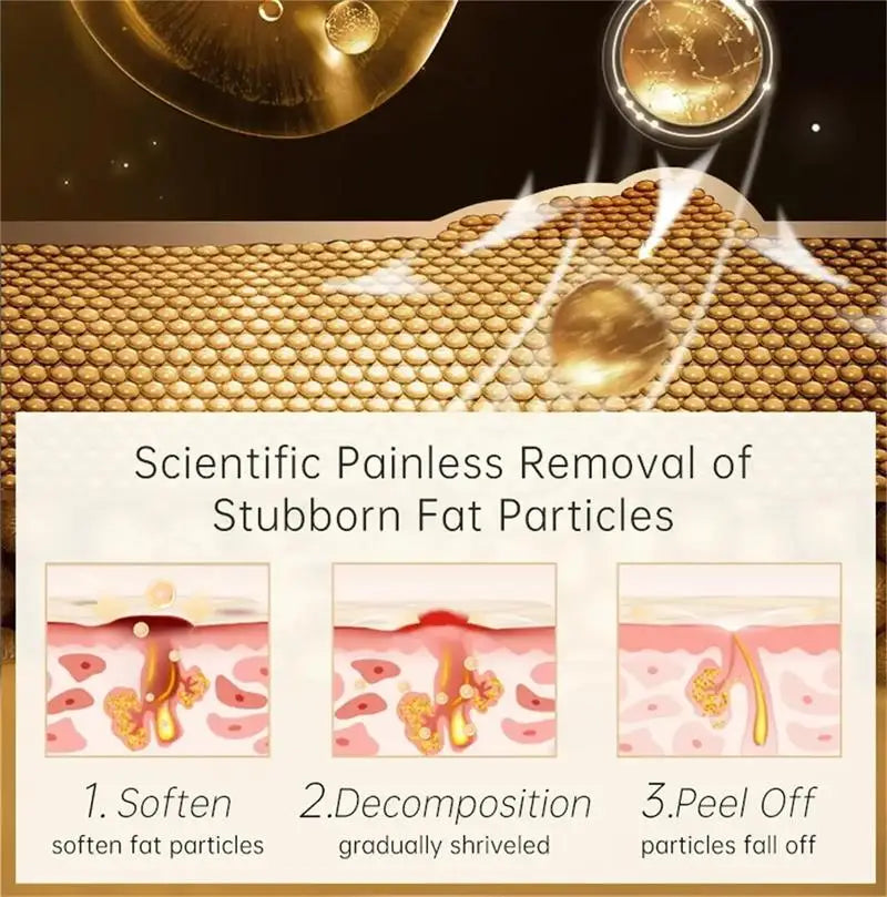 Fat Granules Remover Eye Cream Anti-Puffiness Anti Inflammatory Reduce Dark Circles Eyebags Fade Lines Moisturizing Eye Care Qme