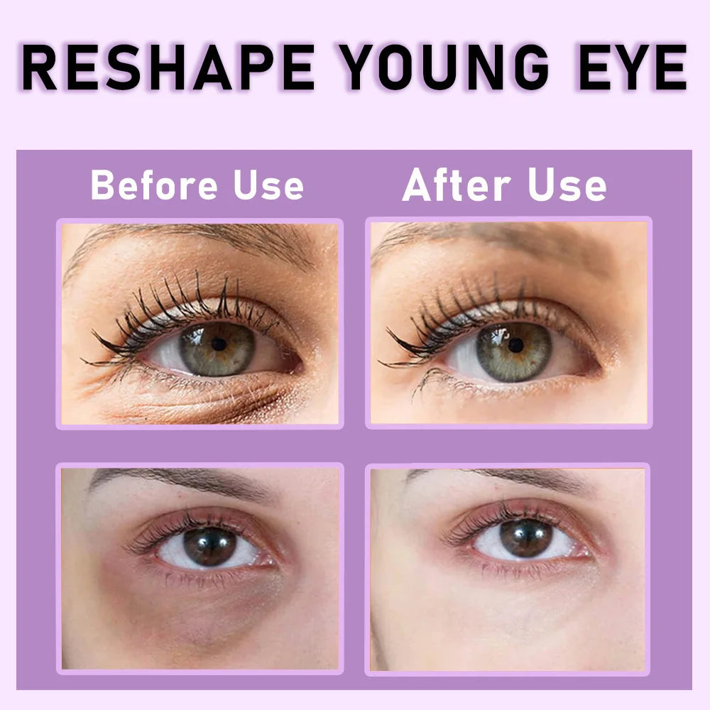 Retinol Firming Eye Cream Reduce Wrinkle Nourishing Faded Dark Circles Improve Eye Bags Puffiness Collagen Niacinamide Cream ﻿ Qme