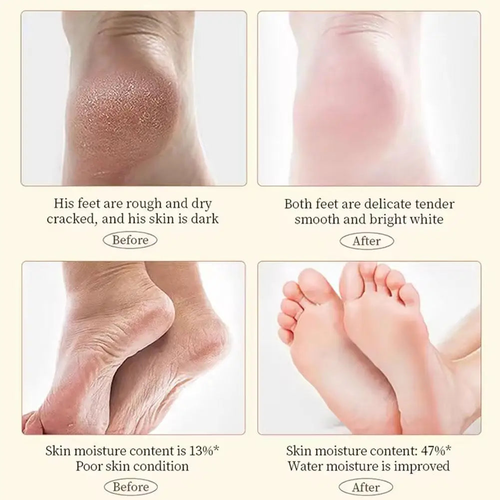 60g Anti Crack Hand Foot Cream Anti-Drying Crack Foot Cream Moisturizing Cracked Heel Repair Restoring Balm Hand Feet Care Qme