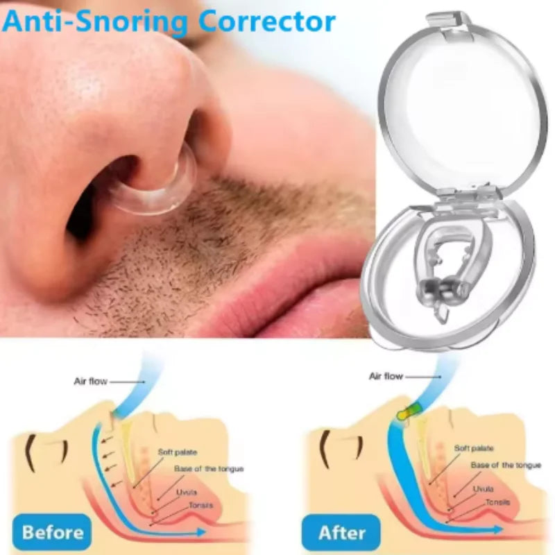 1/3/5/10pcs Anti Snoring Device Magnetic To Stop Snoring Nose Clip For Easy Breathing Improvement Sleep Assistance Apnea Qme