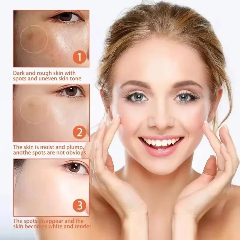 Powerful Spot-Removing Whiten Cream Brighten Skin Fast Eliminates Melanin Pigmentation Melasma Dark Spots Korean Face Skin Care Qme