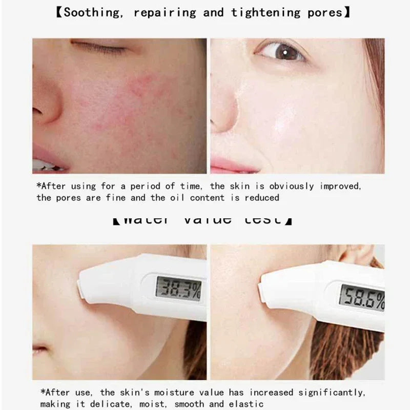 Centella Collagen Sleeping Facial Masks Skincare Anti Wrinkle Qme