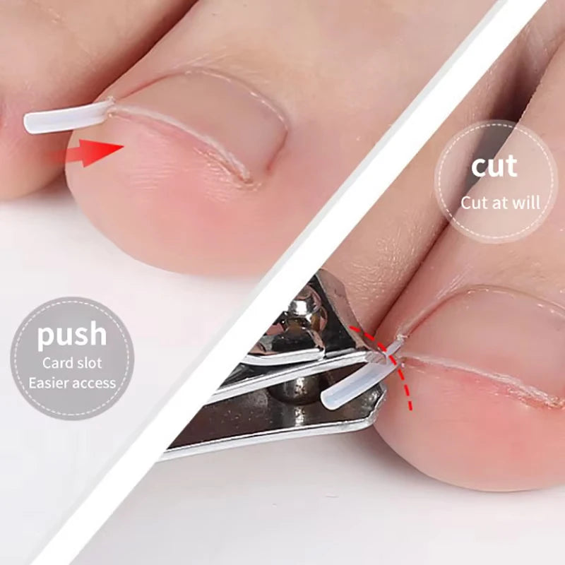 Invisible Toe Nail Surface Support Stickers Daily Foot Shaping Beauty Qme
