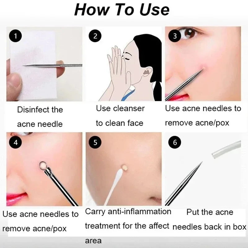 4PCS Blackhead Remover Acne Needle Tools Set Face Cleaning Black Dots Pimple Comedone Extractor Pore Cleaner Skin Care Products Qme