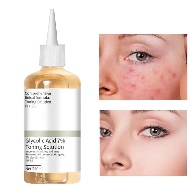 Glycolic Acid 7 Toning Solution Remove Acne Moisturize Skin Qme