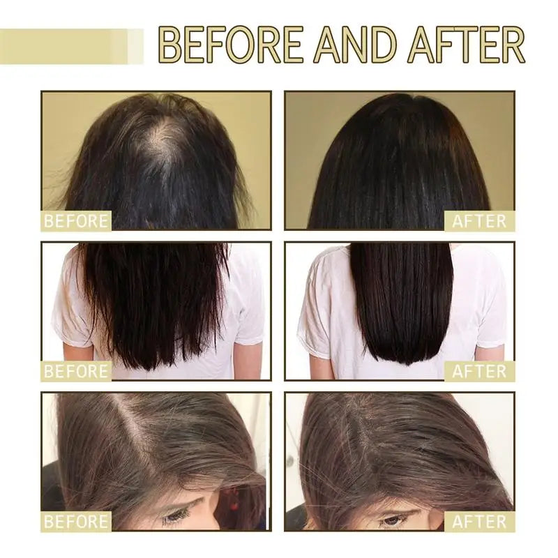 Natural Hair Growth Oil Rosemary Anti Hair Loss Regrowth Moisturizing Repair Anti Baldness Fast Hair Growth Serum Oil Qme