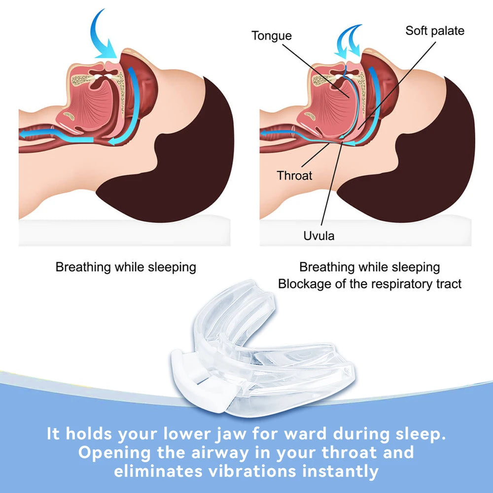 Anti Snoring Tooth Brace Adjustable Mouth Guard Easy Breathe Improve Qme