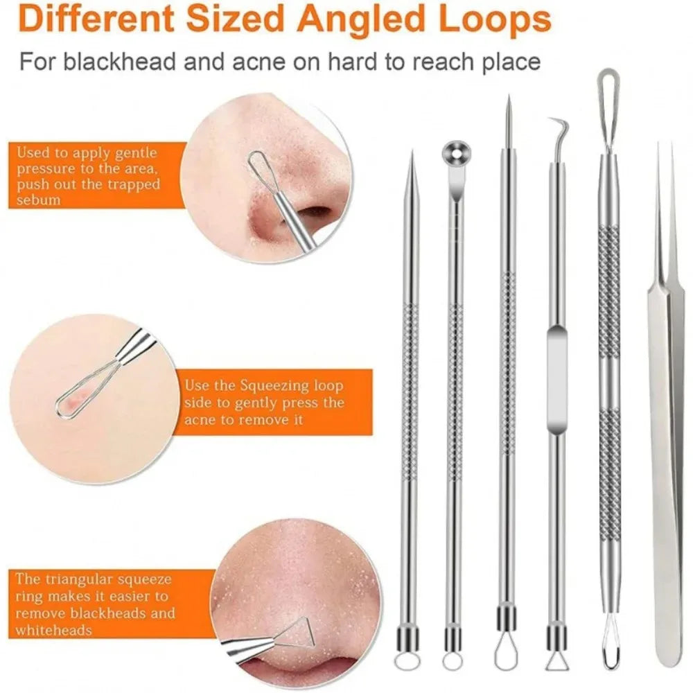 Stainless Steel Blackhead Remover Tools Comedone Extractor Tweezers Qme