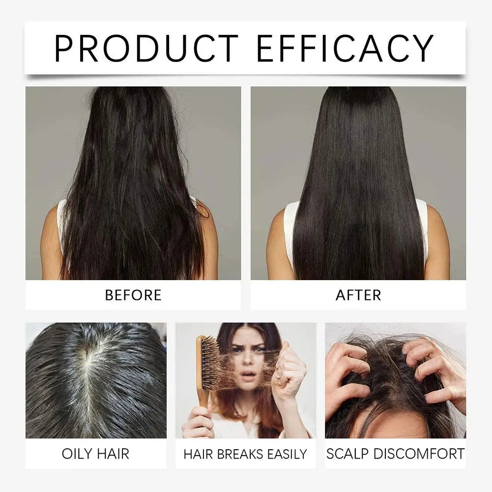 30 Biotin Hair Serum Rosemary Ginger Growth Oil Men Women Help Grow Qme