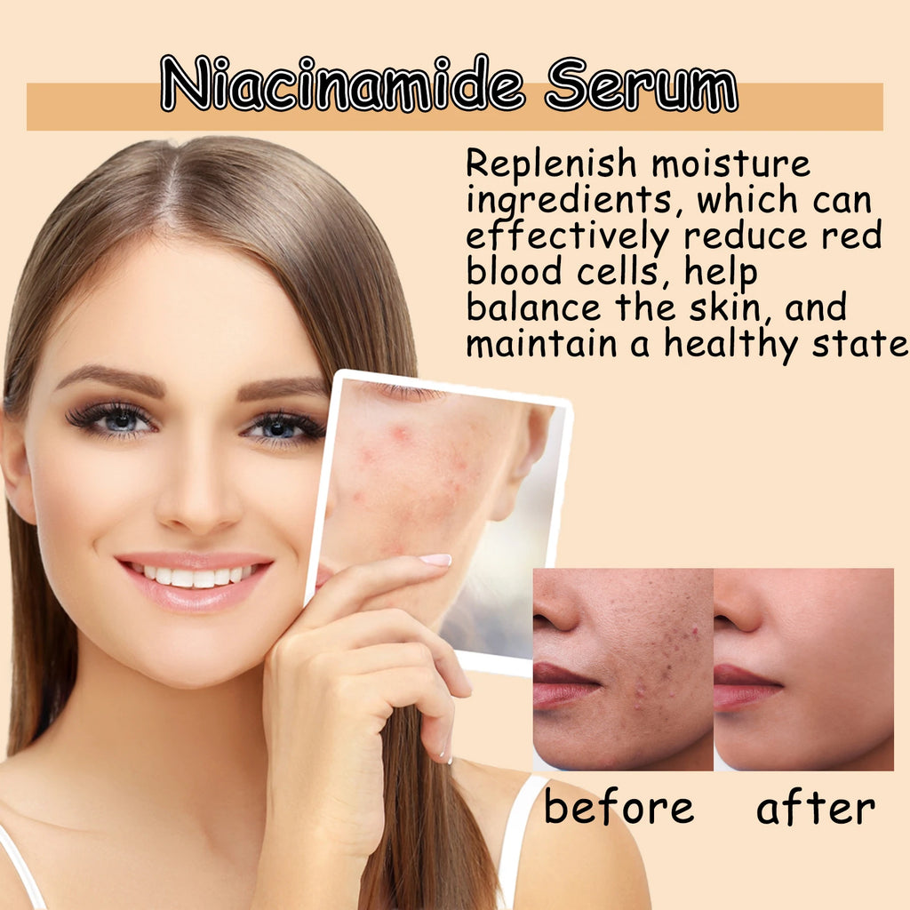 Nicotinamide Face Serum Brightening Moisturizing Smoothing Shrink Pores Facial Essence Glowing Facial Moisturizer for Daily Skin Qme