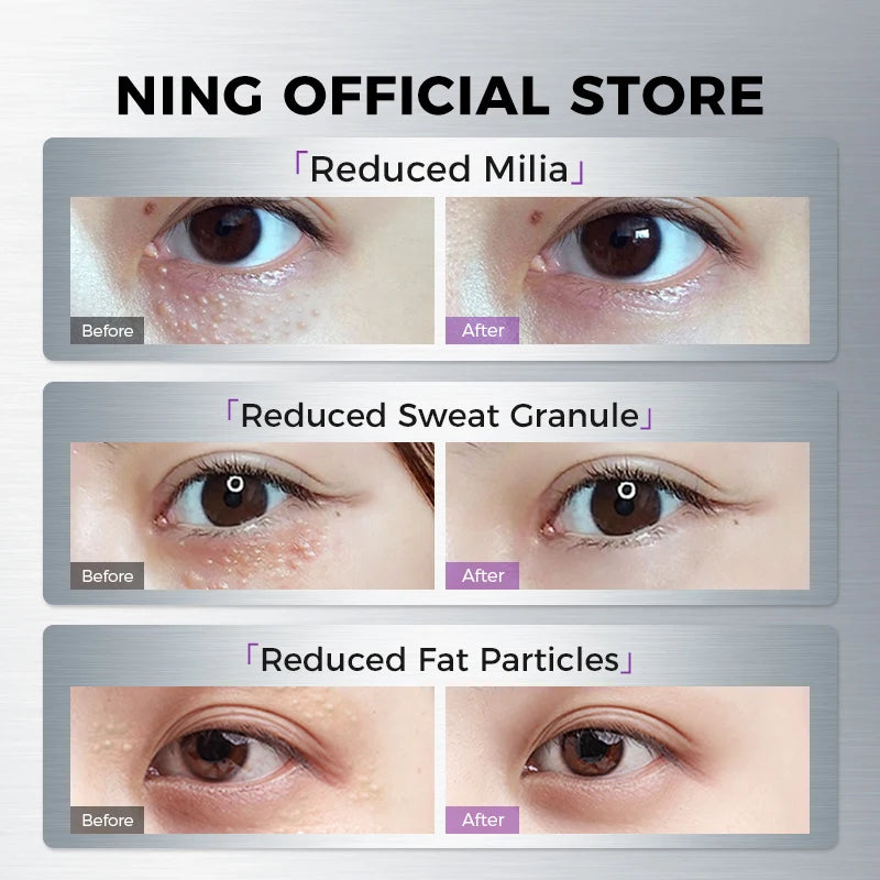 NING Lifting Tightening Eye Essence Zinc Fermented Yeast Peptides Qme
